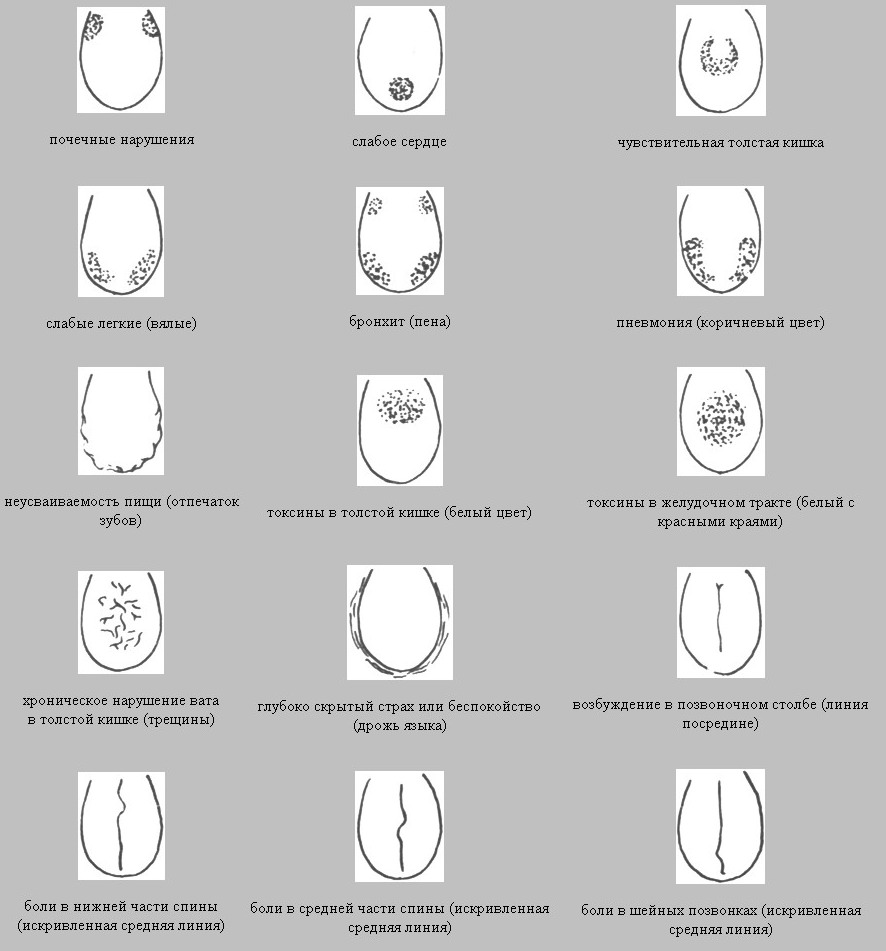 Определение болезни по языку в картинках диагноз. Болезни по языку определить. Заболевания по цвету языка.